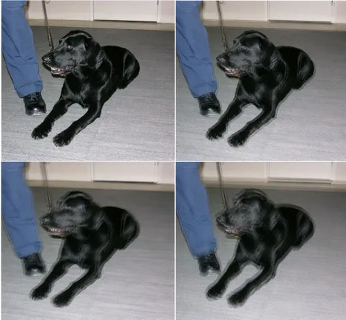 Призрак изображения (Ghosting) после LASIK