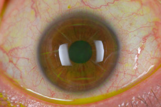 click for larger image