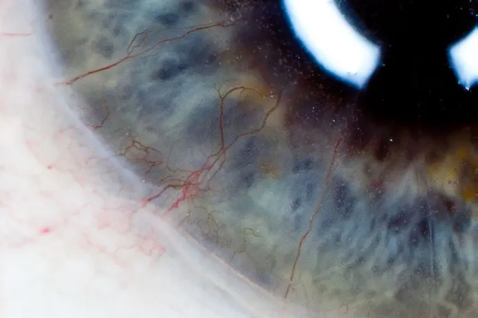 Файл из архива RKSurvivors: brent_jesperson-neovascular_med.jpeg